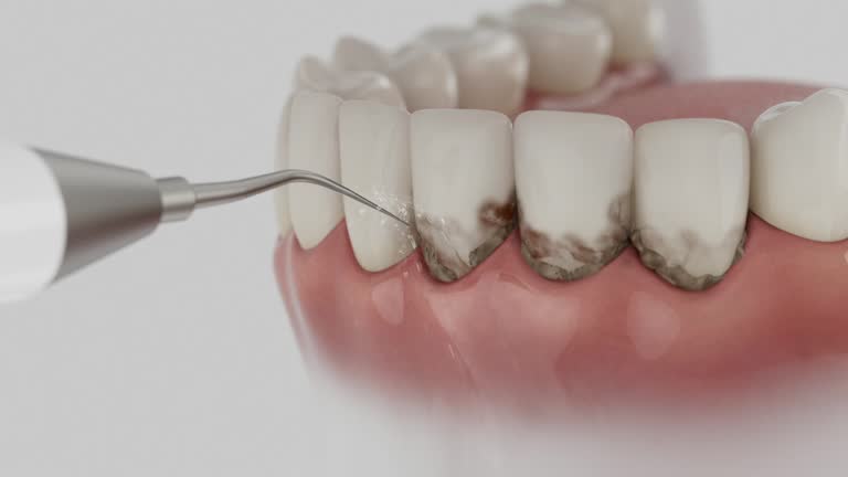 Trusted Dental Implants service in Wintersville, OH - Dentist Open Now
